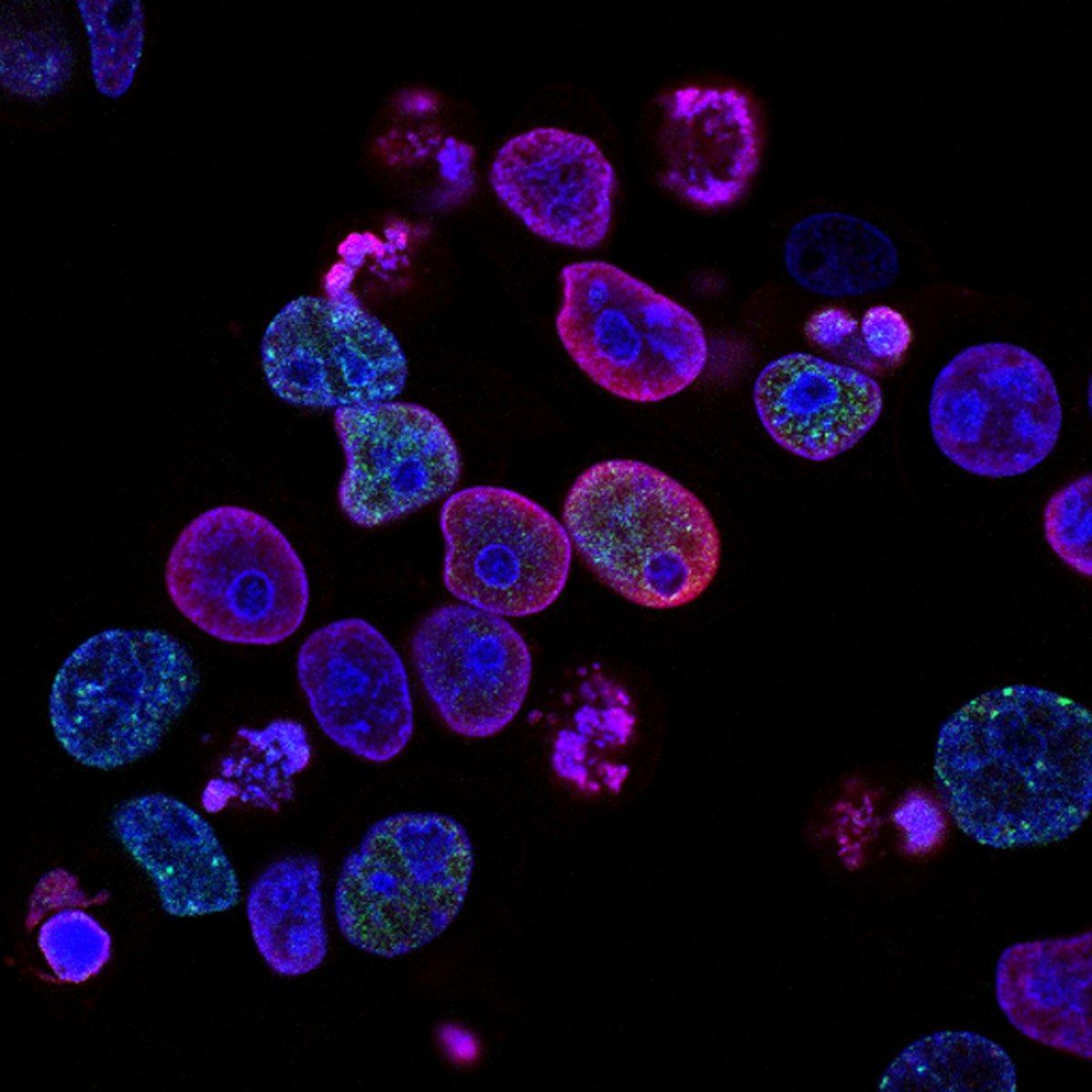 Fisetin: A Senolytic in Your Fruit Bowl